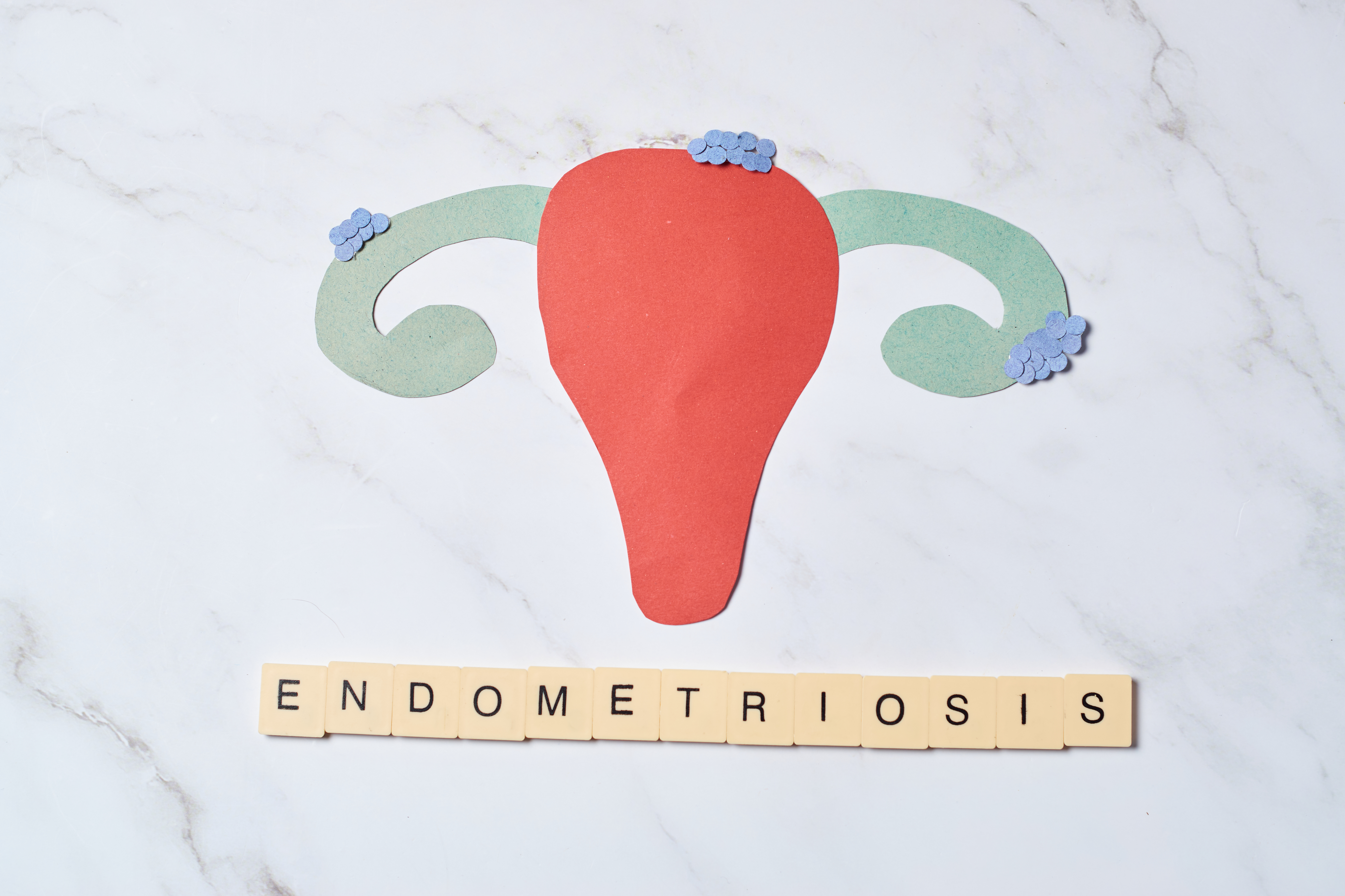 An illustration of a uterus with the word endometriosis displayed underneath in Scrabble lettering.